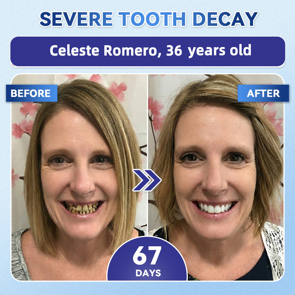 GаrаgеLіnе® 🇳🇿🦷 Tideglusib Fast‑Dissolving Tooth & Gum Repair Oral Strips 😁 (Supports tooth repair and helps relieve gum discomfort and other common oral concerns)