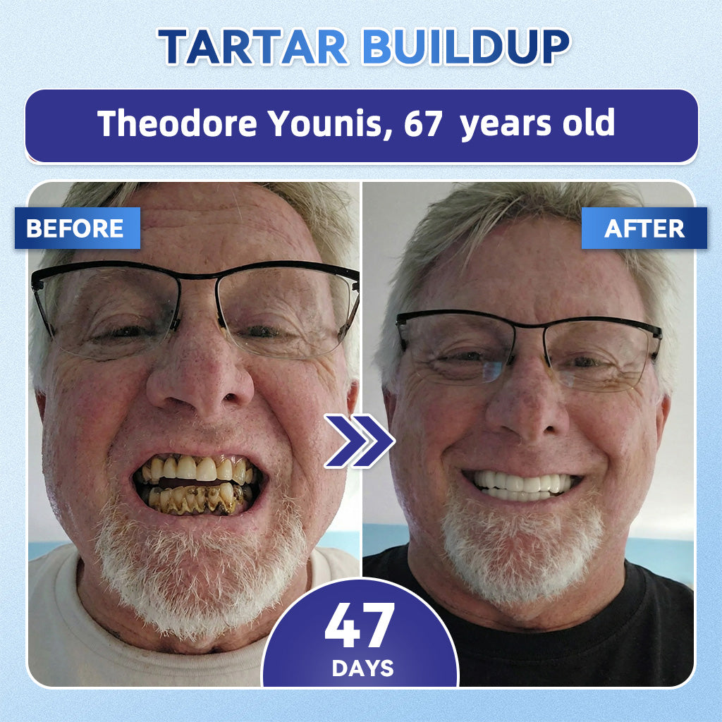 GаrаgеLіnе® 🇳🇿🦷 Tideglusib Fast‑Dissolving Tooth & Gum Repair Oral Strips 😁 (Supports tooth repair and helps relieve gum discomfort and other common oral concerns)