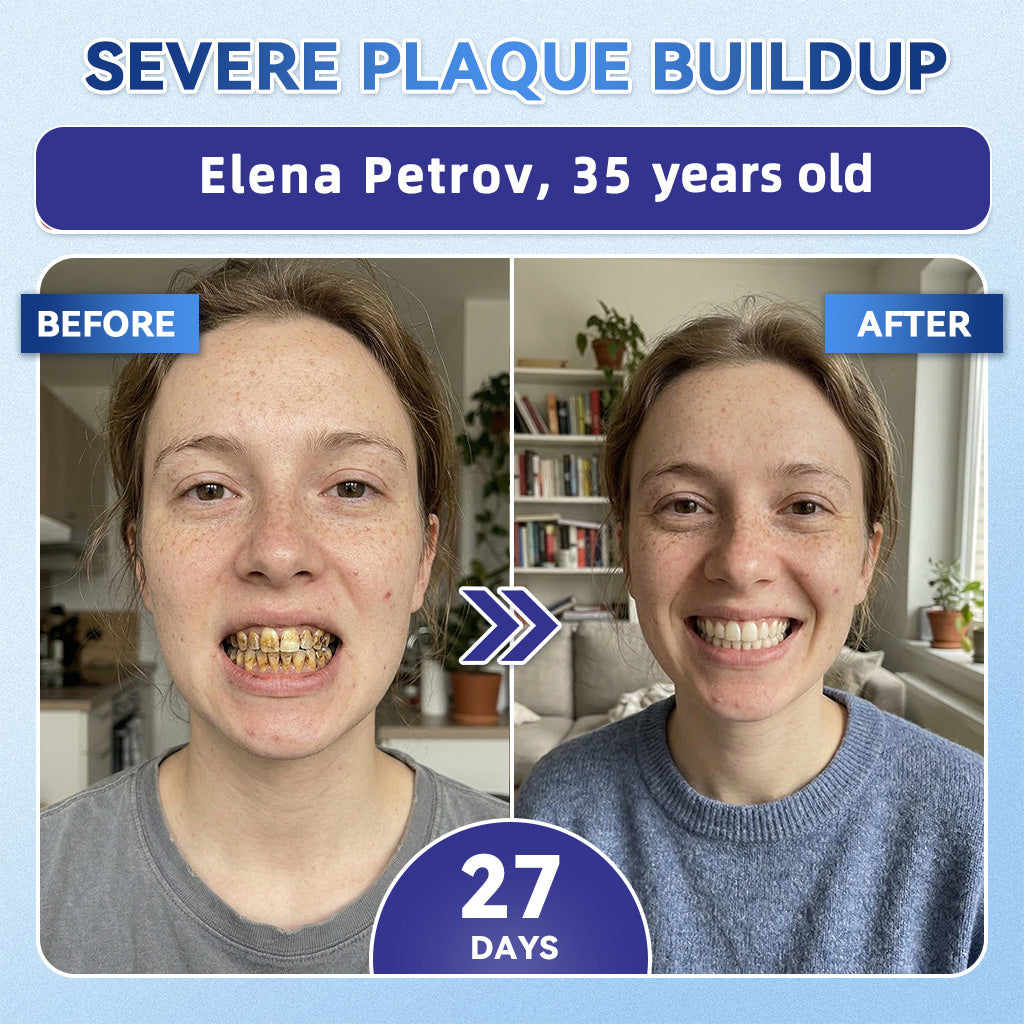 GаrаgеLіnе® 🇳🇿🦷 Tideglusib Fast‑Dissolving Tooth & Gum Repair Oral Strips 😁 (Supports tooth repair and helps relieve gum discomfort and other common oral concerns)