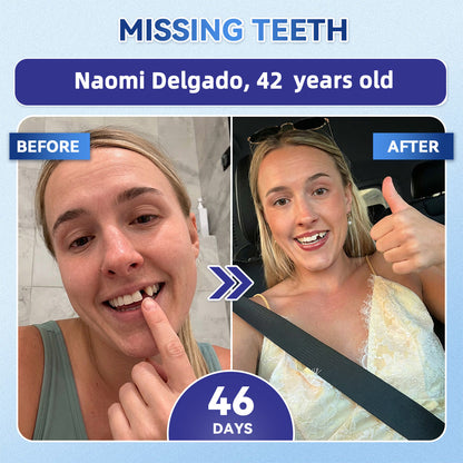 GаrаgеLіnе® 🇳🇿🦷 Tideglusib Fast‑Dissolving Tooth & Gum Repair Oral Strips 😁 (Supports tooth repair and helps relieve gum discomfort and other common oral concerns)