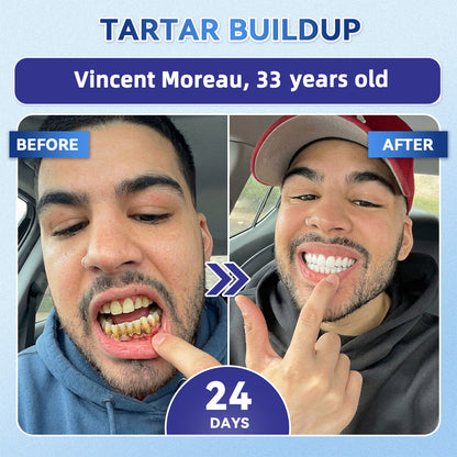 GаrаgеLіnе® 🇳🇿🦷 Tideglusib Fast‑Dissolving Tooth & Gum Repair Oral Strips 😁 (Supports tooth repair and helps relieve gum discomfort and other common oral concerns)
