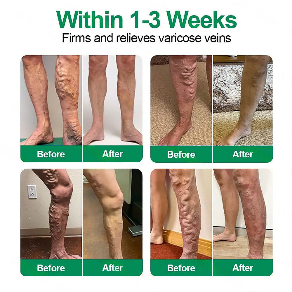 👨‍⚕️👍✅Healrize® VeinTarget Microneedle Patch⚡Instant Relief, Long-Term Results