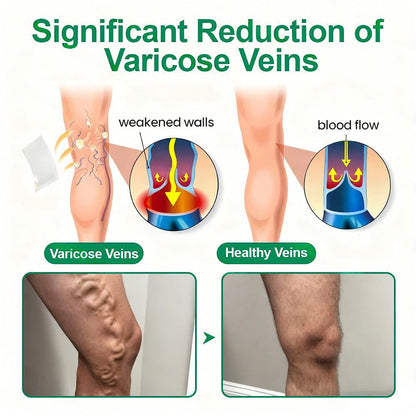 👨‍⚕️👍✅Healrize® VeinTarget Microneedle Patch⚡Instant Relief, Long-Term Results