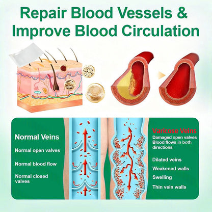 👨‍⚕️👍✅Healrize® VeinTarget Microneedle Patch⚡Instant Relief, Long-Term Results